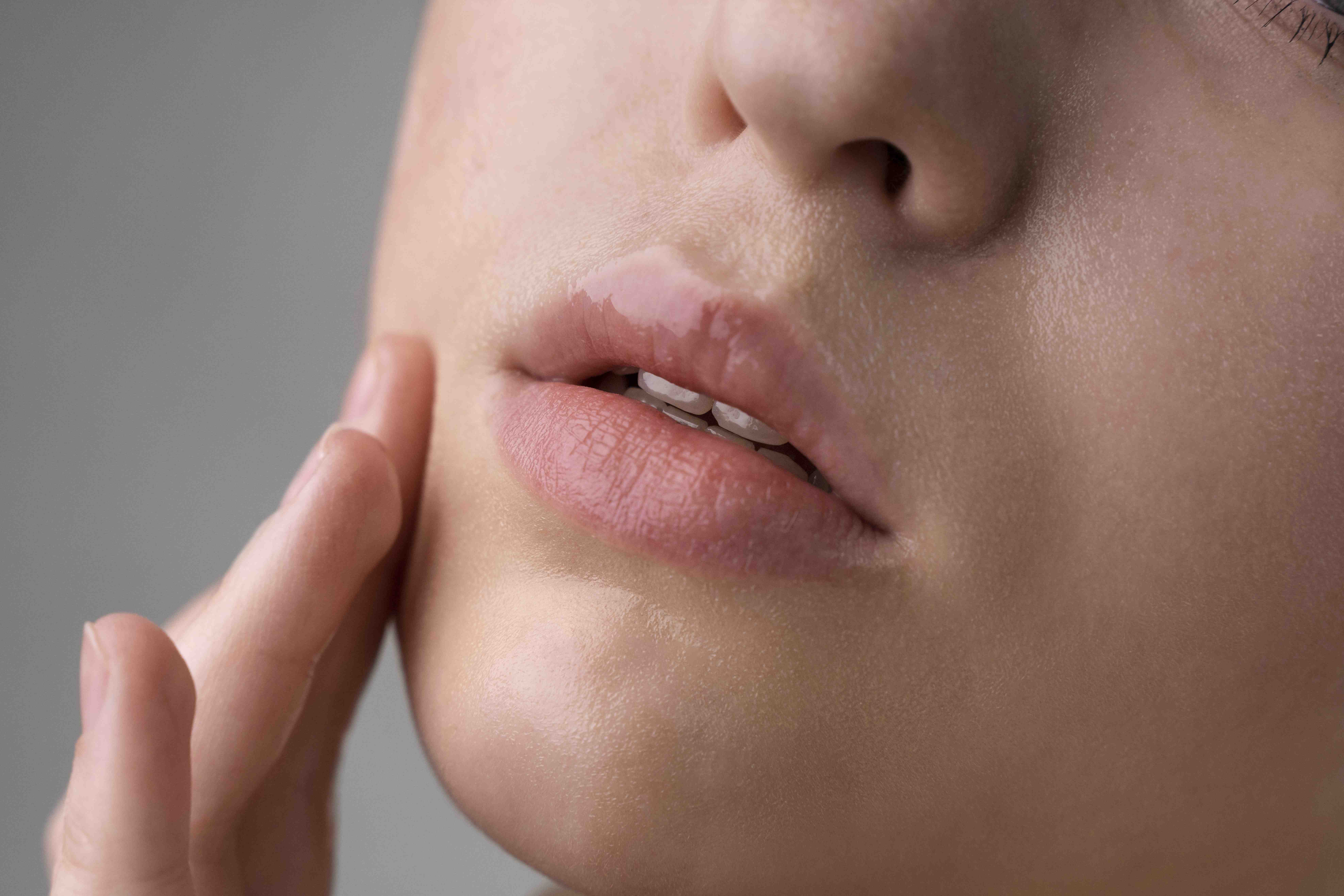Lip Filler | Enhance Your Lips for Full Smooth Youthful