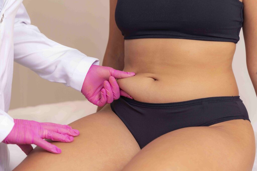 Achieve a Naturally Look with Fat Dissolving Injections